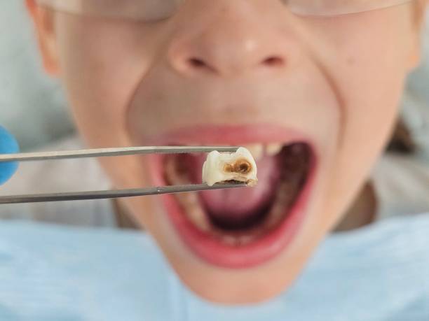 Best Emergency Tooth Extraction  in Far Hills, NJ