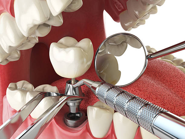 Best Chipped Tooth Repair Near Me  in Far Hills, NJ